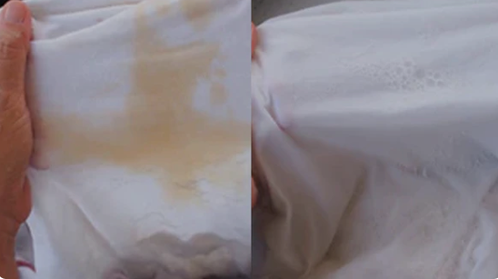 How to remove detergent stains from clothes